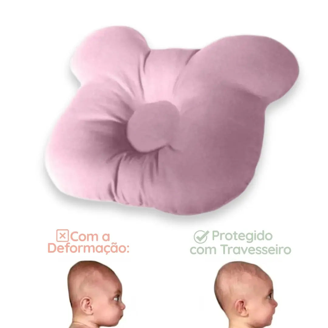 Travesseiro para Bebê Prevenção Cabeça Chata Plagiocefalia Corpo & Colo