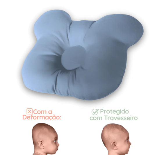 Travesseiro para Bebê Prevenção Cabeça Chata Plagiocefalia Corpo & Colo